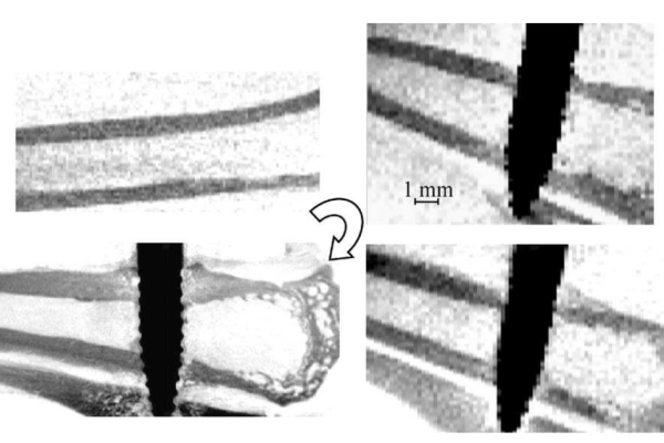 Individualised, Micro-CT-based Finite Element Modelling As a Tool for Biomechanical Analysis Related to Tissue Engineering of Bone